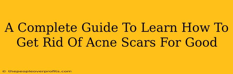 A Complete Guide To Learn How To Get Rid Of Acne Scars For Good